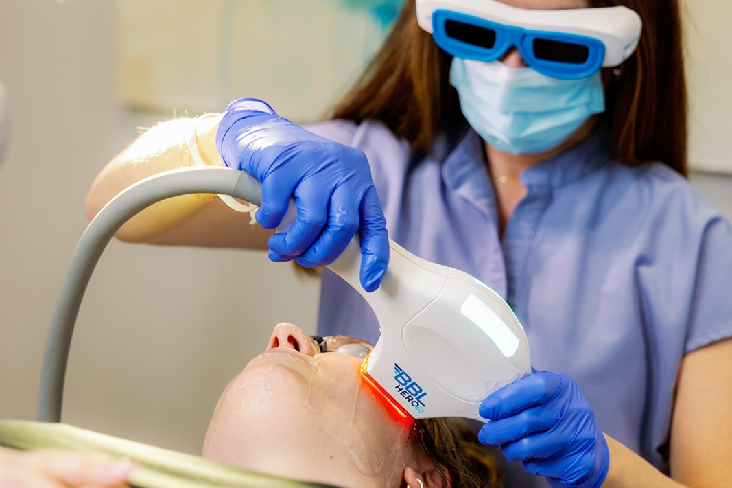 BBL Treatment 