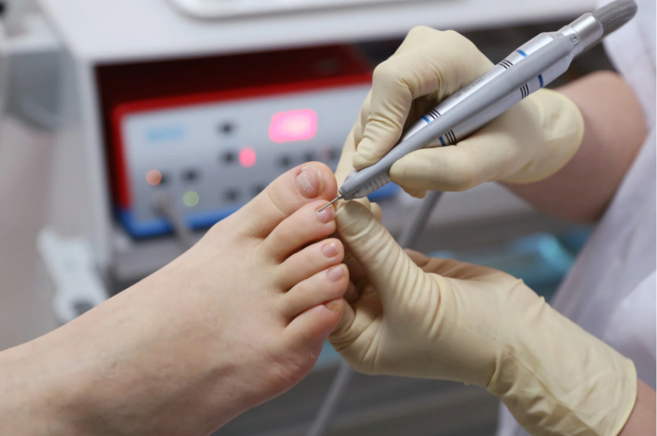 podiatrist and ingrown toenail