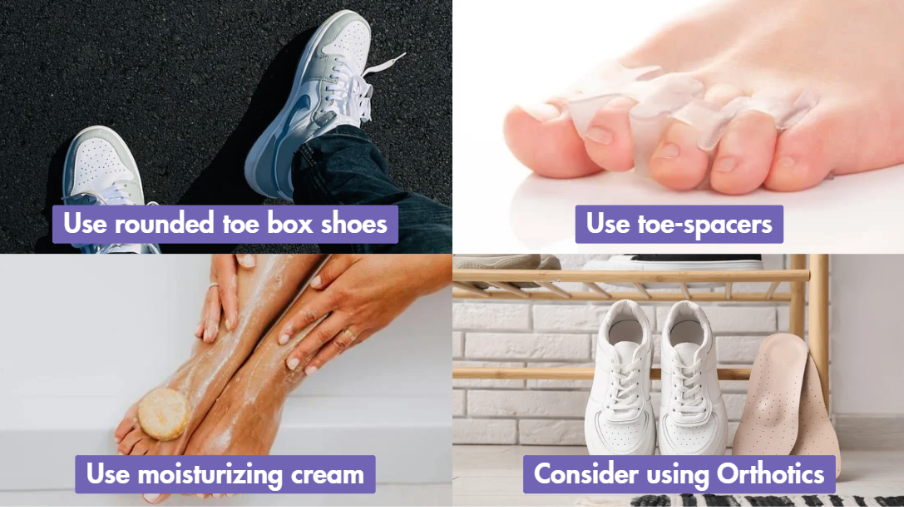 prevent corn on the pinky toe