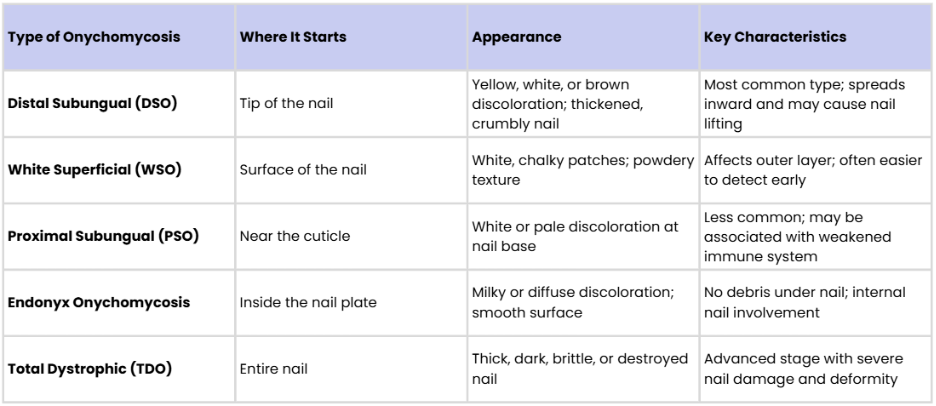 Table comparing different types of toenail fungus, including where they start, appearance, and key characteristics