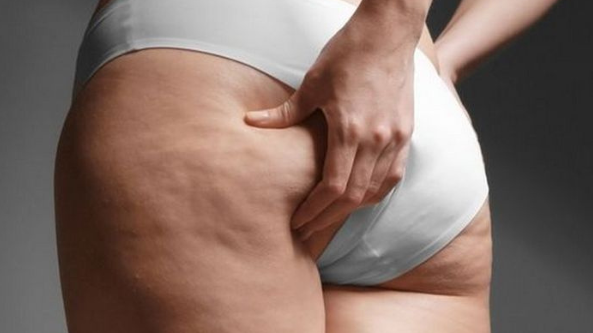 Pourquoi la cellulite devient plus visible avec le temps ?