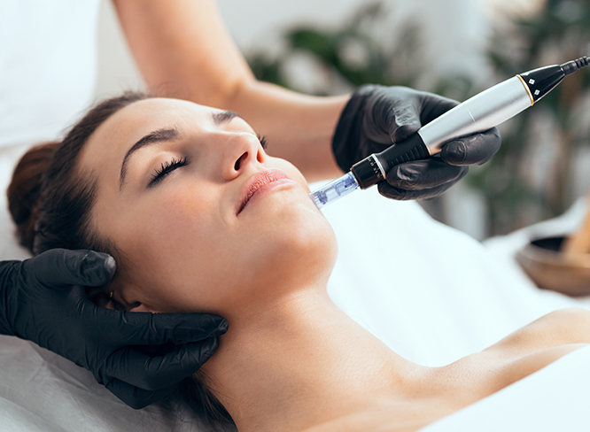 Peeling ou microneedling : et si le plus intéressant était de les associer ?