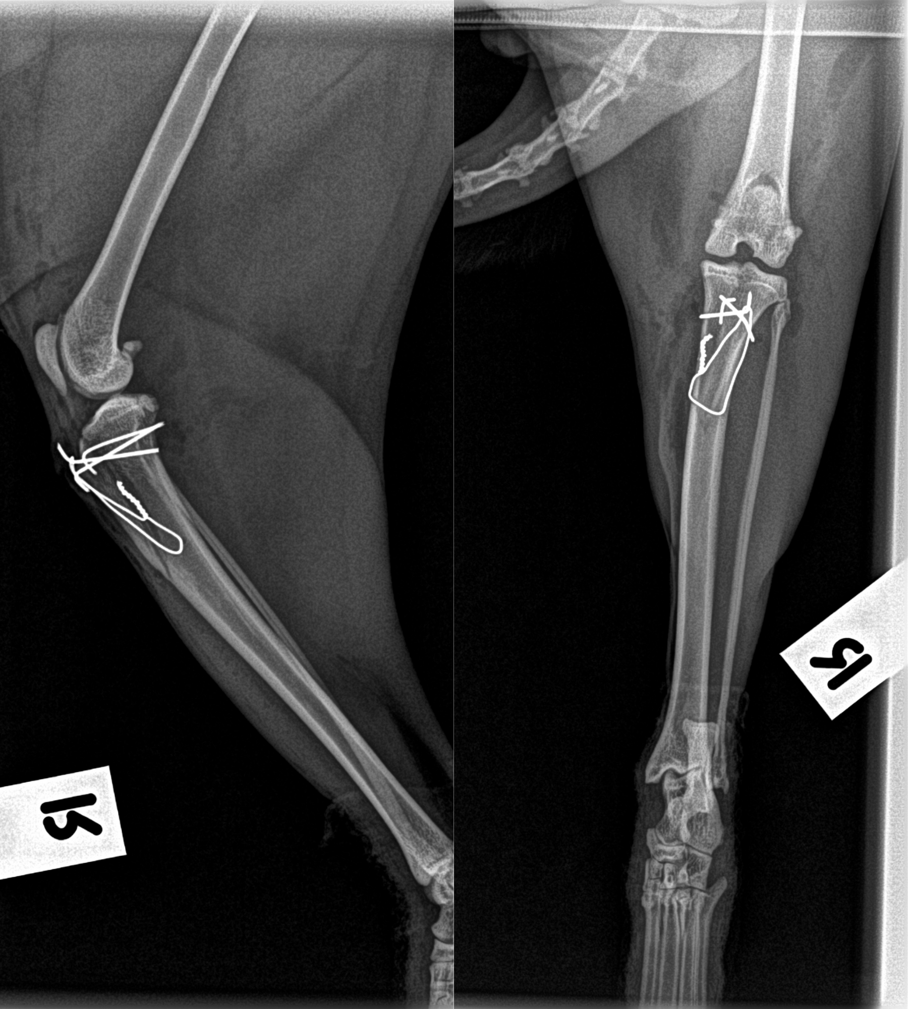 xrays showing patella alignment after surgery