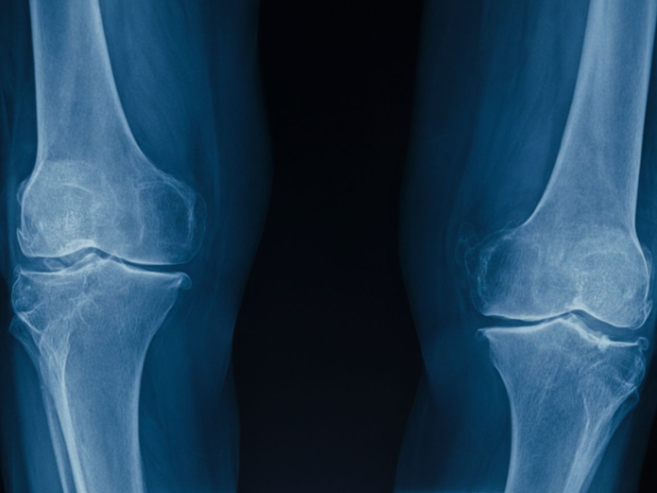 Mobility is the freedom. Freedom is mobility