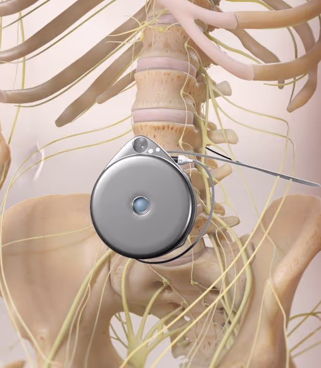 Aparatos Implantables