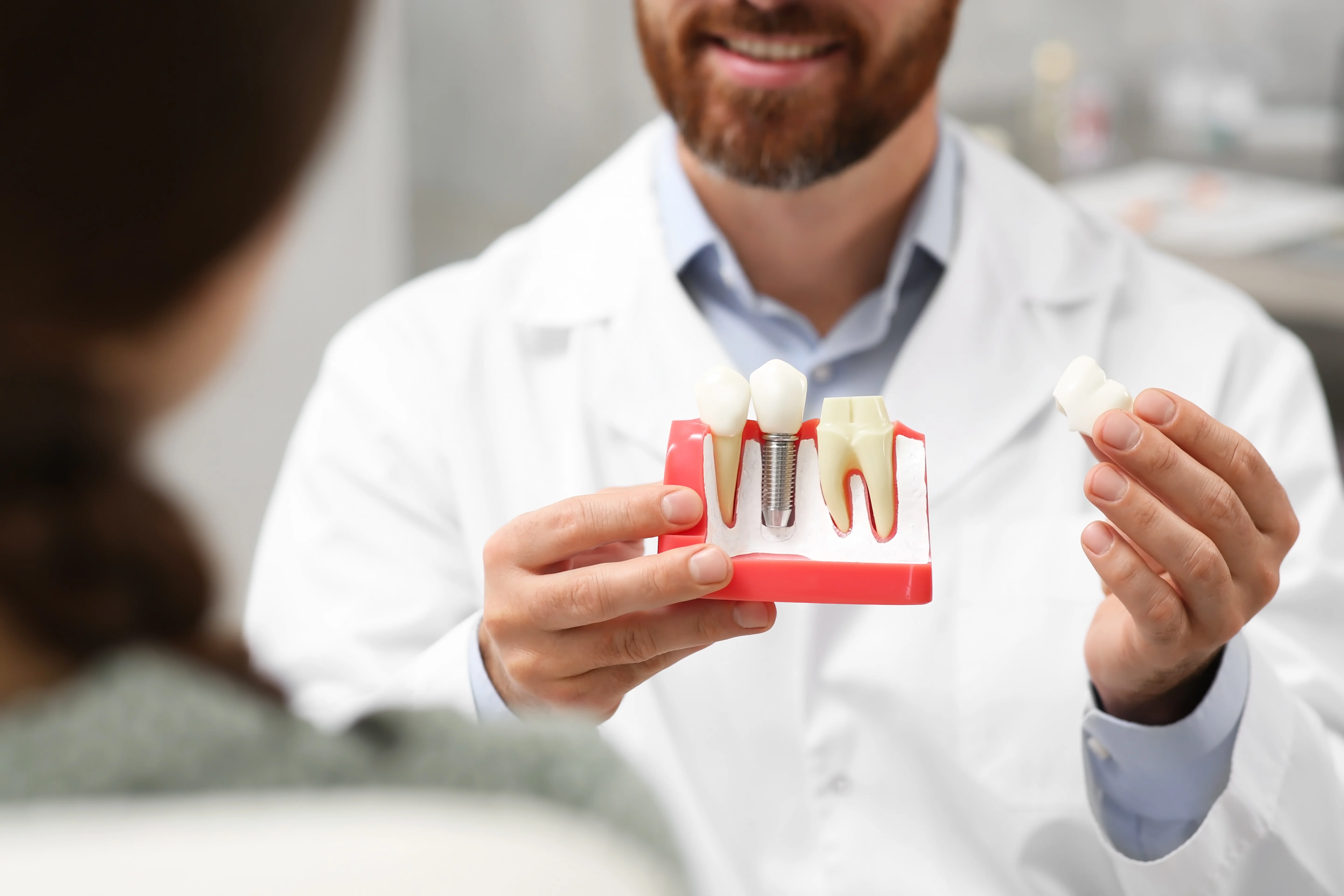 Dental implant cost in Texas 2026