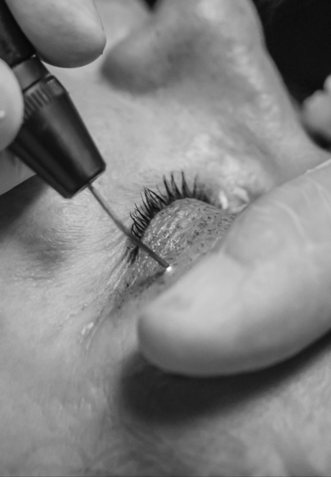 We proudly serve clients from Edmond, OK, Oklahoma City, OK, Arcadia, OK, Deer Creek, OK, and Jones, OK. Explore other services like Anti-Wrinkle Injections, Dermal Fillers & Biostimulators, and Plasmage to complement your aesthetic treatment plan.