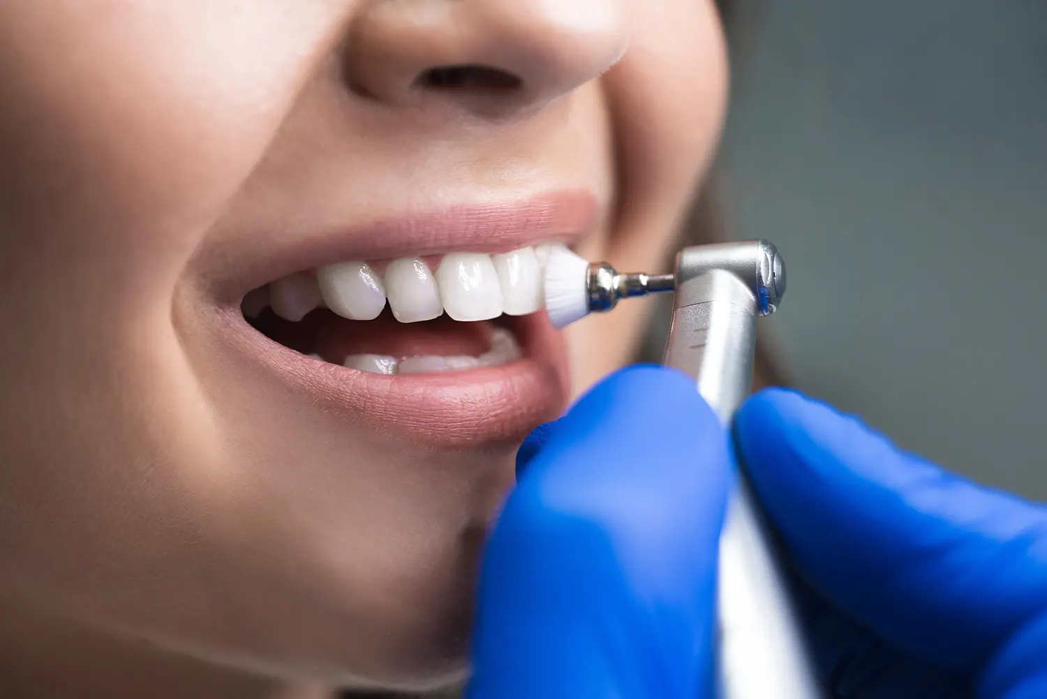 Cleanings & Exams in Rancho Santa Margarita, CA