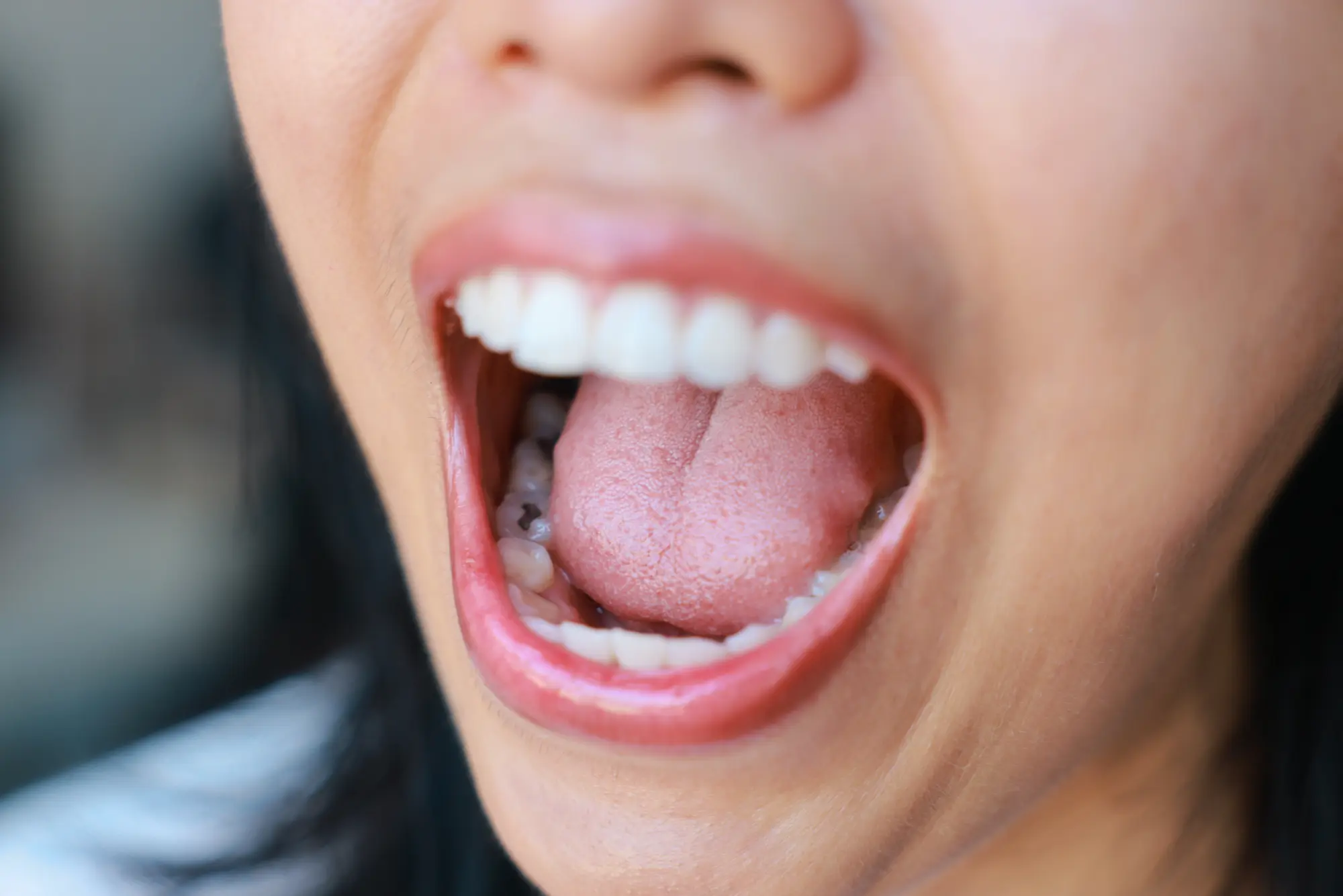 what does a cavity feel like and how to prevent them