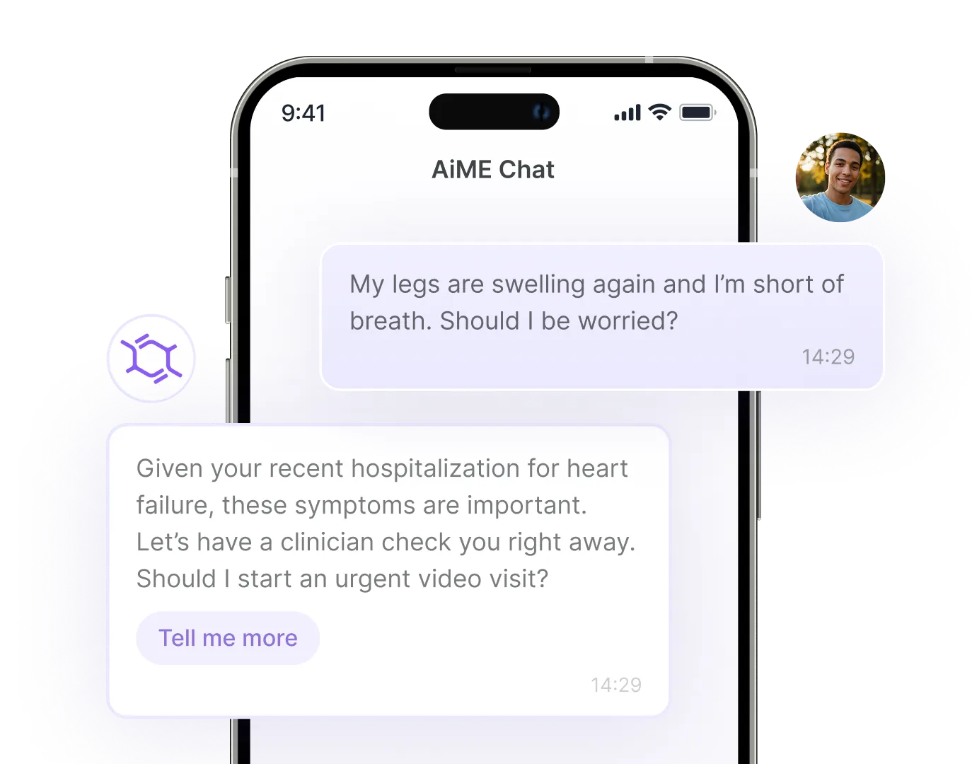 Smartphone screen showing a chat in AiME Chat app where a user asks about swollen legs and shortness of breath, and the AI suggests urgent video visit due to recent heart failure hospitalization, with a 'Tell me more' button.