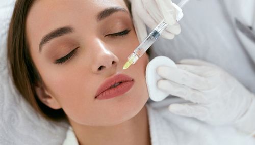 Yvoireで精密な唇の輪郭形成