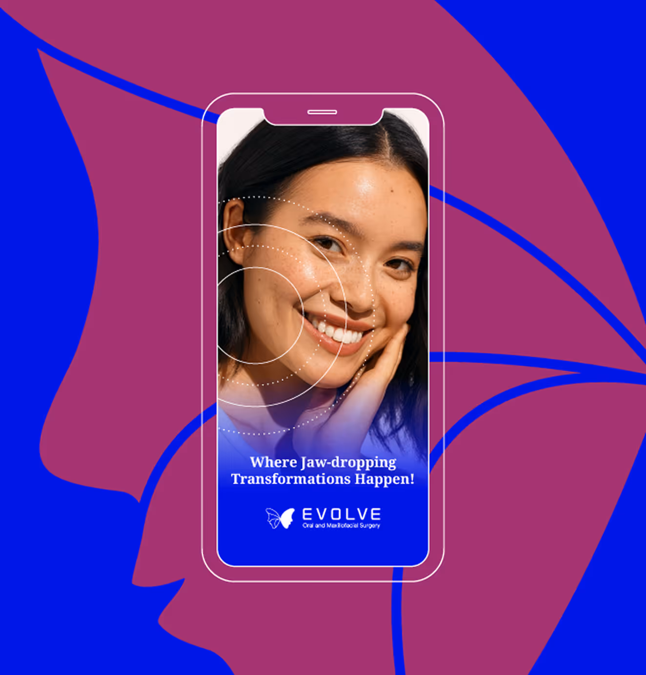 Smartphone screen showing a smiling woman with dotted facial mapping lines, captioned “Where Jaw-dropping Transformations Happen!” alongside the Evolve logo.
