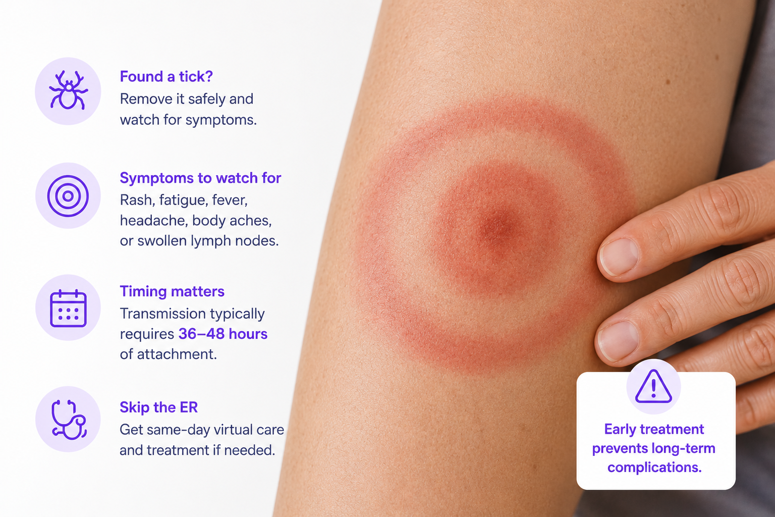 Found a Tick This Summer? Here’s Why You Don’t Need the ER, and What to Do Instead