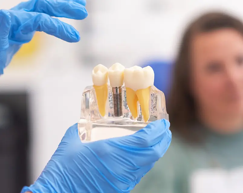 Single Tooth Implant