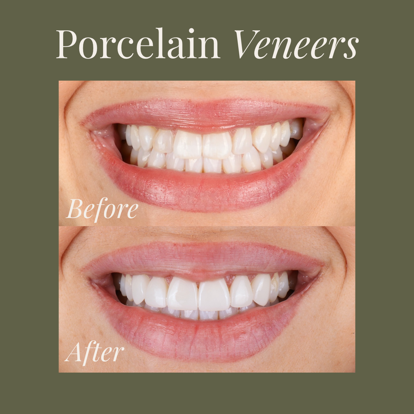 Patient during dental exam for gum disease deep cleaning treatment in Chattanooga