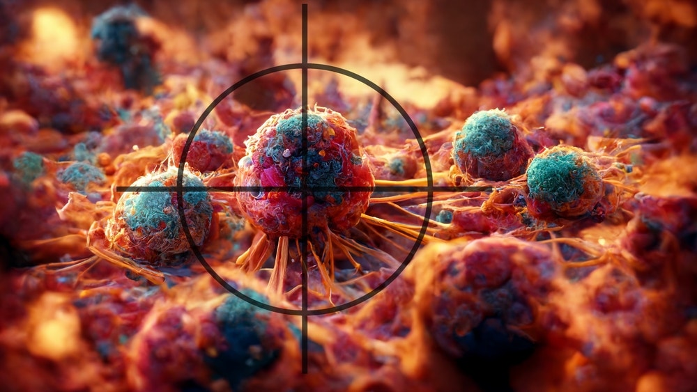 FDA Rejects Replimune's Blood Cancer Drug, Stock Sinks