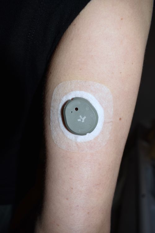 continuous glucose monitor ciclo well clinic