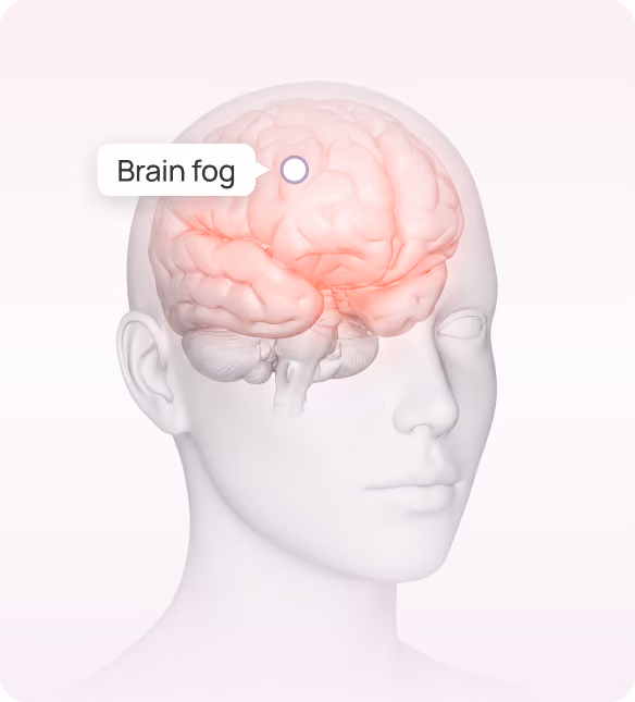 3D human head with transparent skull showing brain highlighted in red for brain fog.