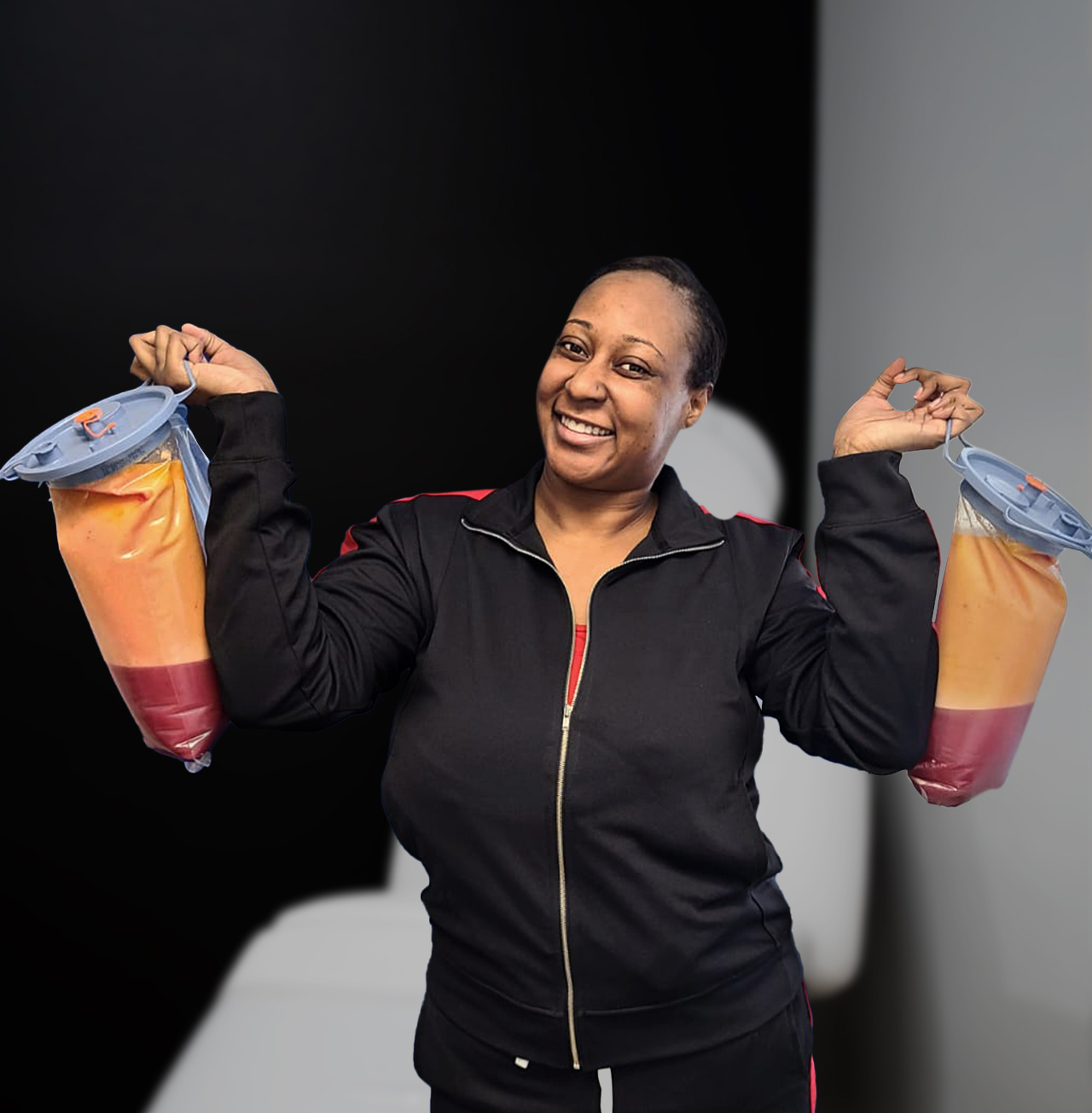 a woman who had her fat removed and is showing how much was removed.