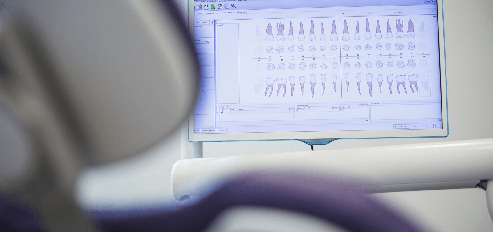 A diagram of an adult set of teeth on a digital screen is part of the process for digitally designed CEREC crowns in Mountain View