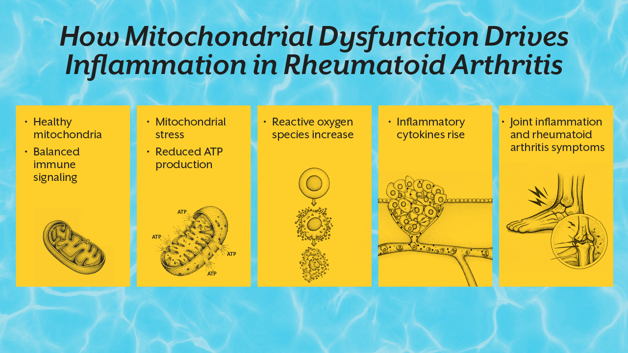 How Mitochondrial Dysfunction Drives Inflammation in Rheumatoid Arthritis