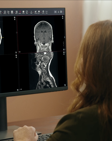 A woman reviewing a medical scan on a desktop monitor