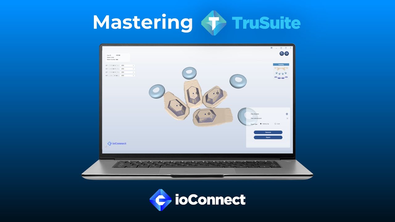 Truabutment Tutorial | Pre-Course Didactics