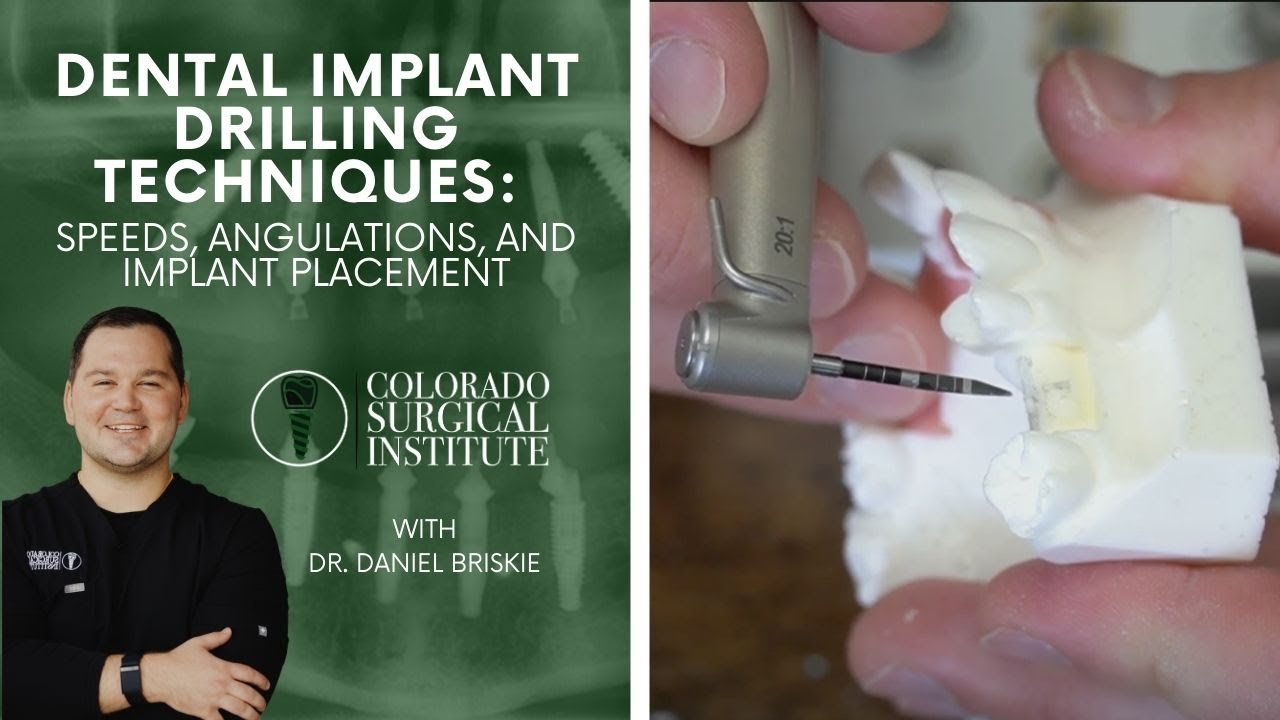 Single Implant Drilling Techniques | Pre-Course Didactics