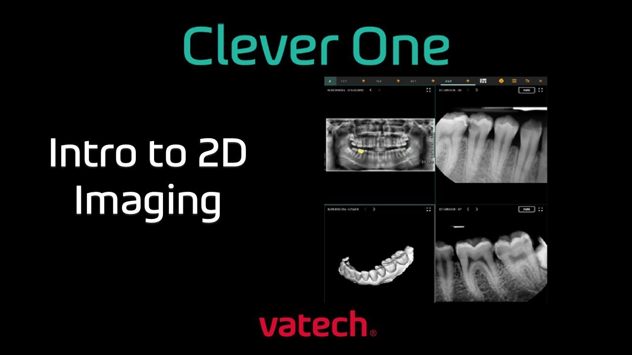 Clevor One Vatech Overview | Pre-Course Didactics