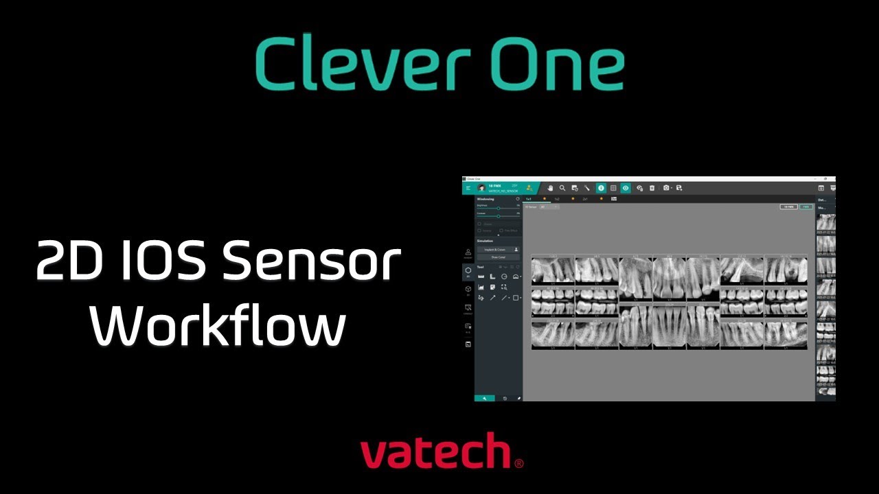 Clevor One Vatech Sensor Imaging Tutorial | Pre-Course Didactics