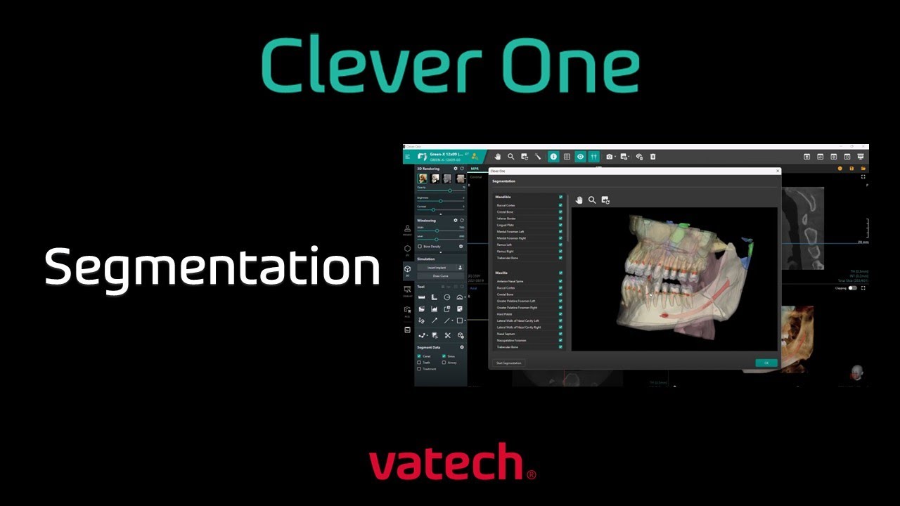 Clevor One Vatech Tutorial Segmentation | Pre-Course Didactics