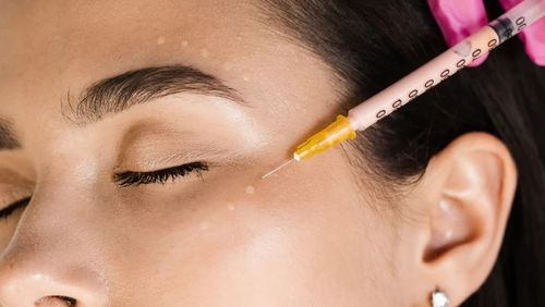 صورة توضح استخدام الفيلر مع الليدوكائين لتقليل الألم وتحقيق نتائج طبيعية.