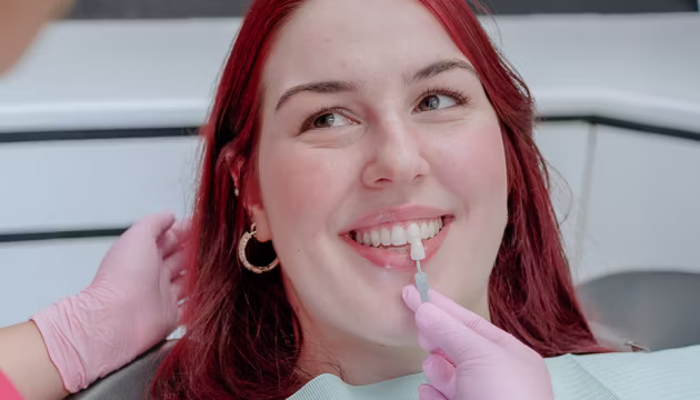 Dentist checking a patient's tooth shade with a shade guide at Cheeky