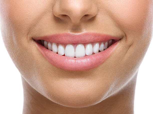 A close up of a white smile. 