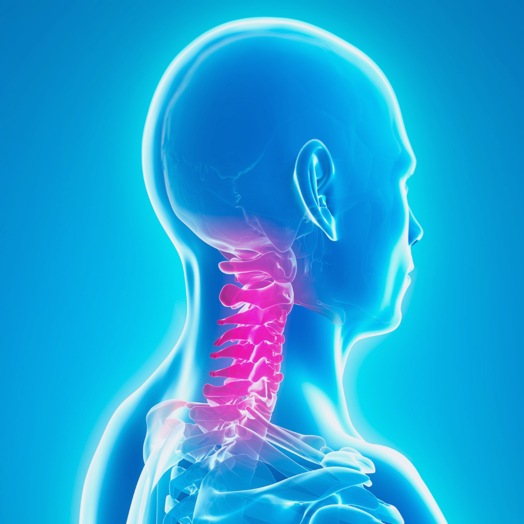 A graphic illustrating a neck injury
