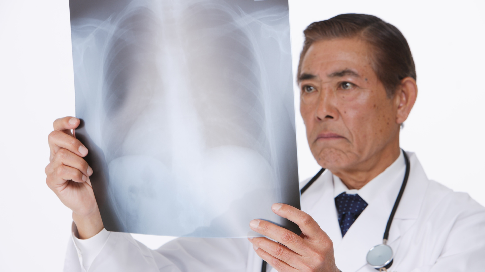 A doctor holding up a chest x-ray as if he's examining it