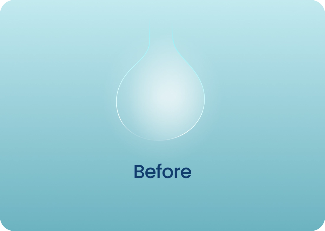 Before - empty