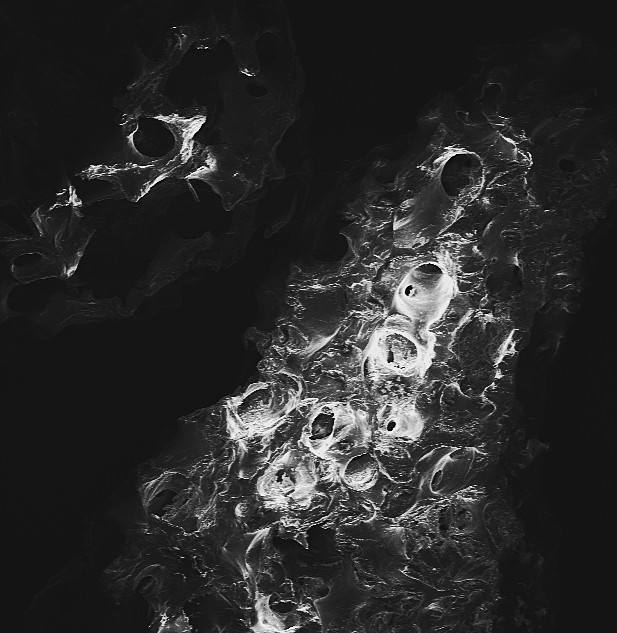 NovaGRAFT Particle