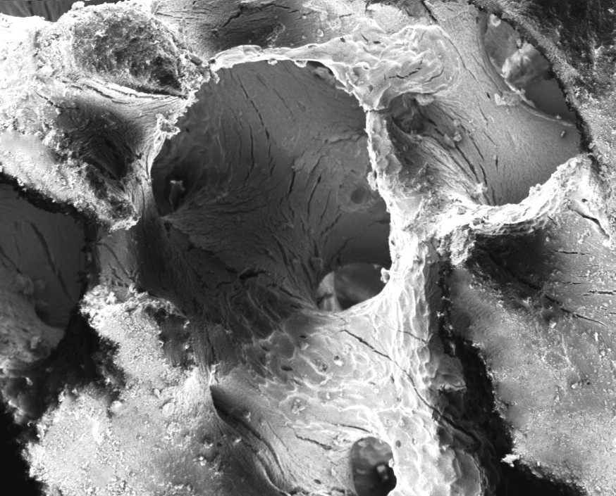 NovaGRAFT Porous Overview
