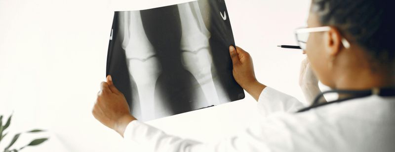 Tractus-iliotibialis-Syndrom (Läuferknie): Symptome erkennen und