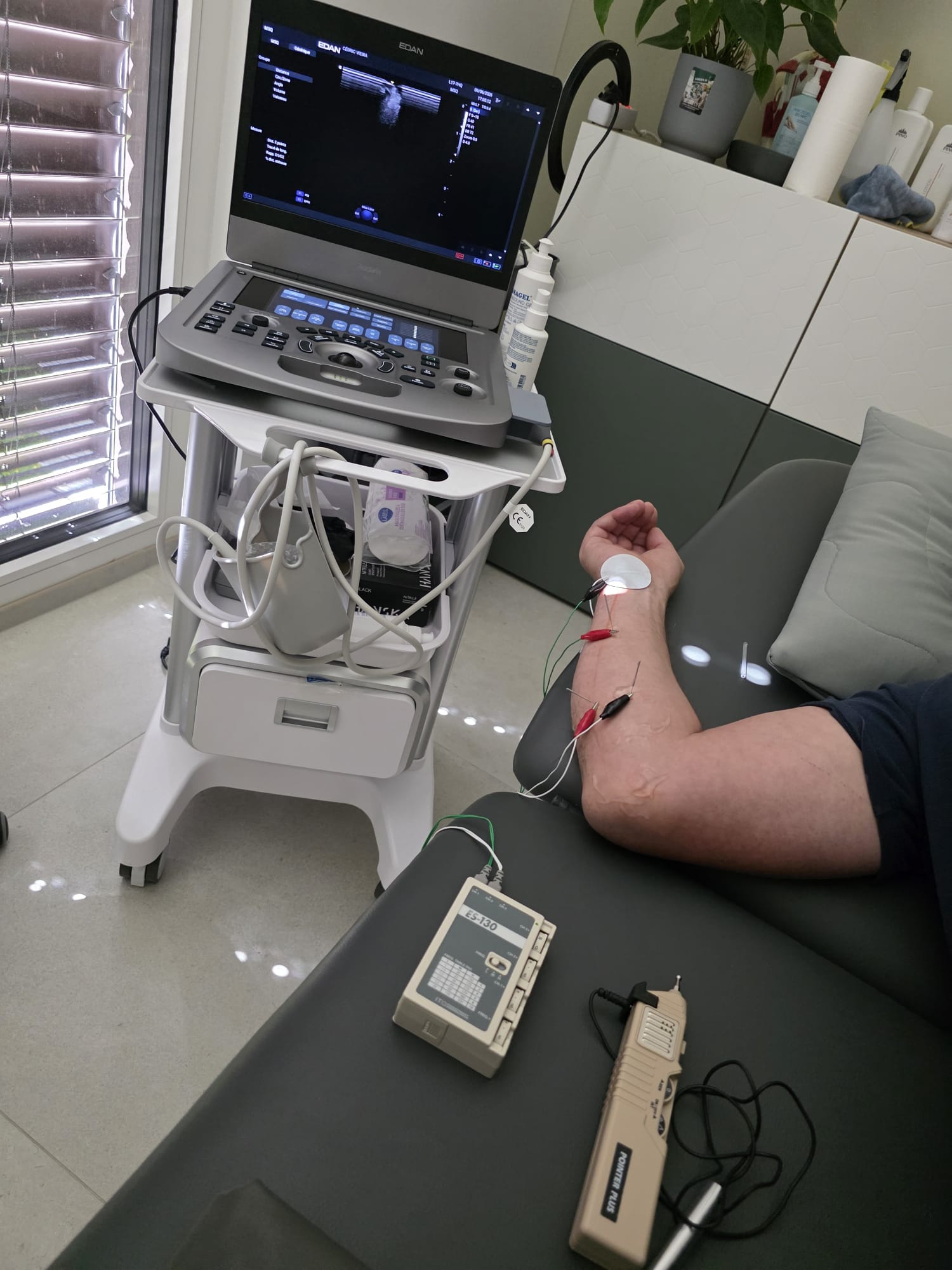 Neuromodulation échoguidée - kinésithérapie invasive guidée par échographie chez Fisiomove