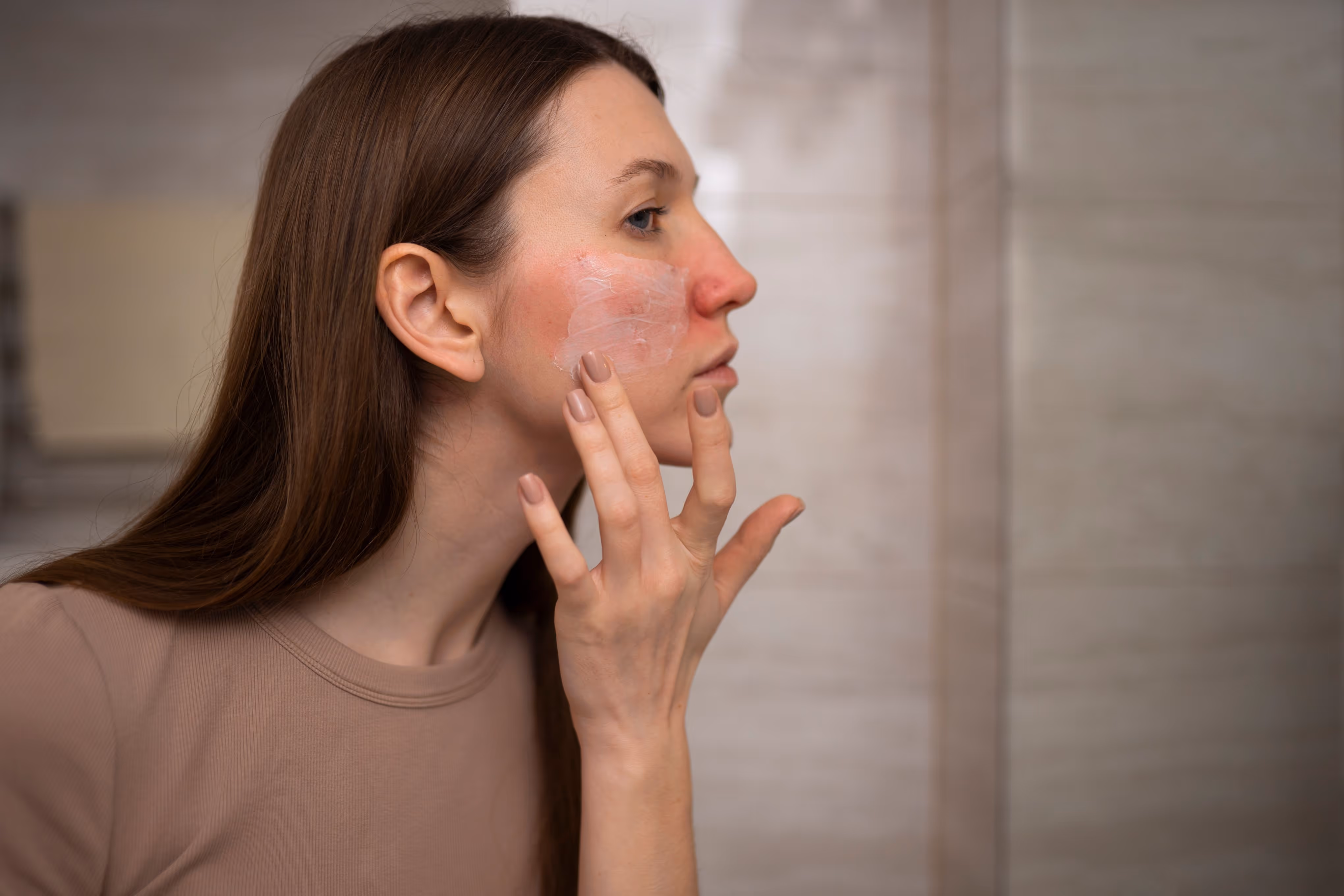 Redness and sensitivity