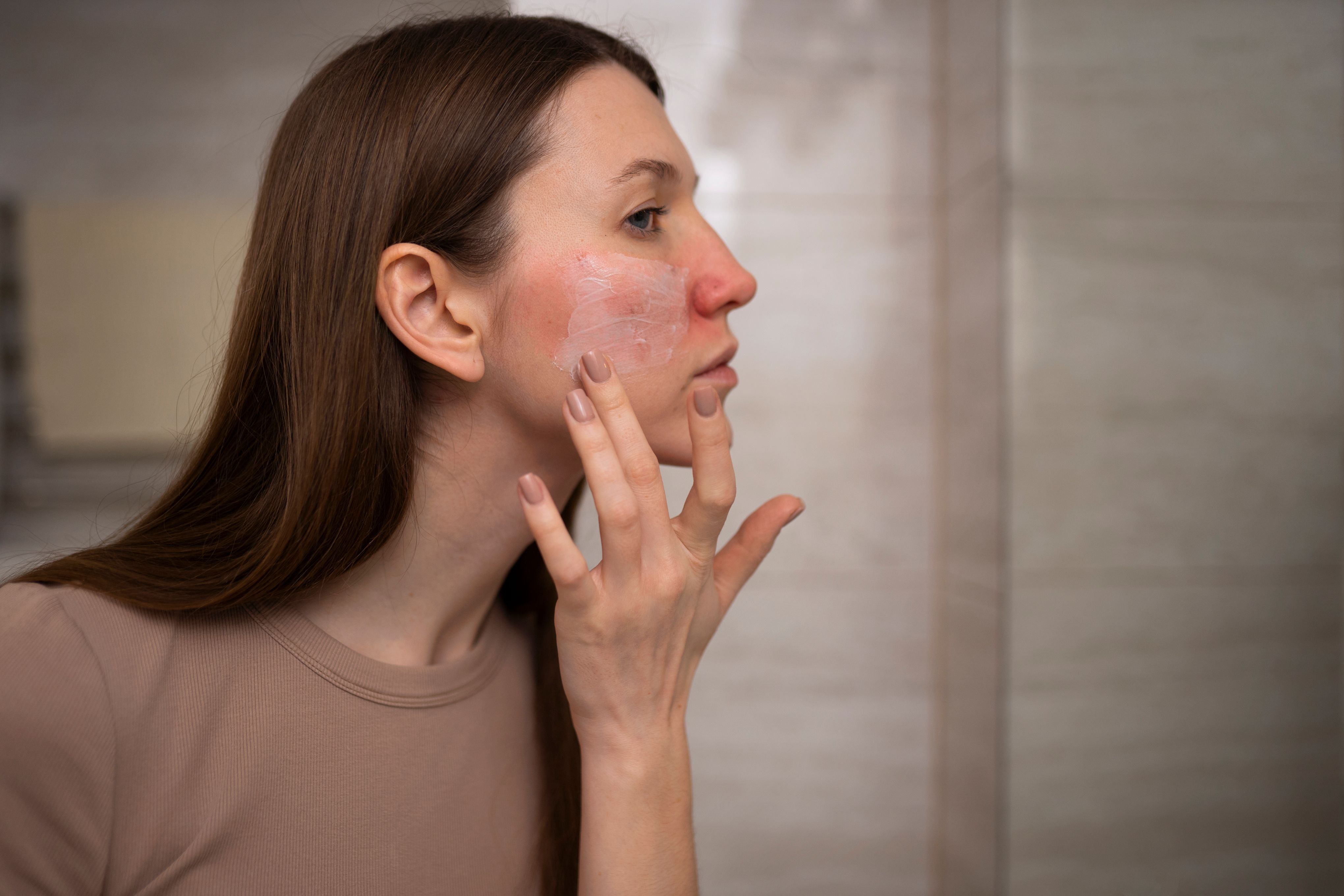 Redness and sensitivity