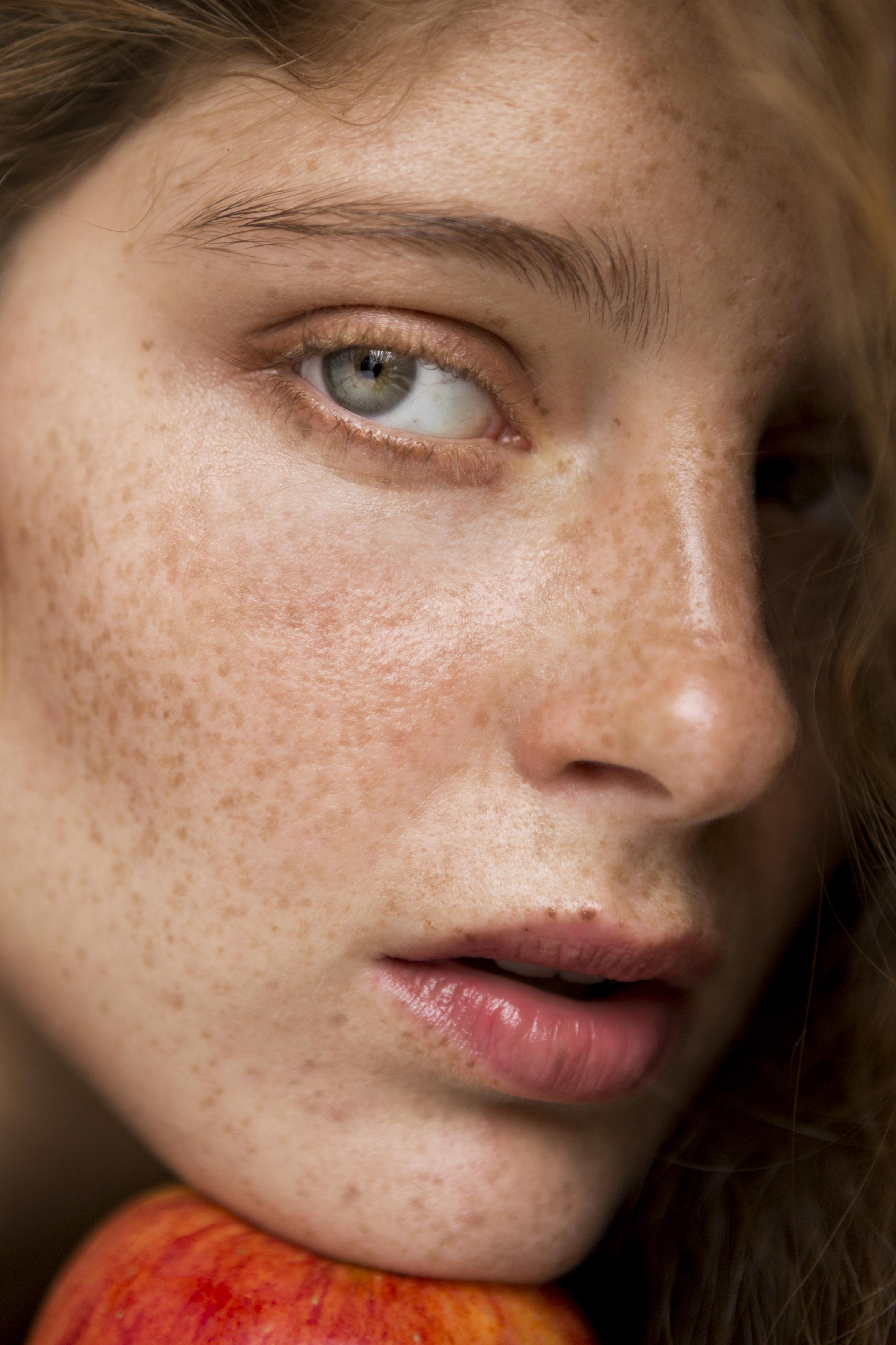 Pigmentation and dark spots