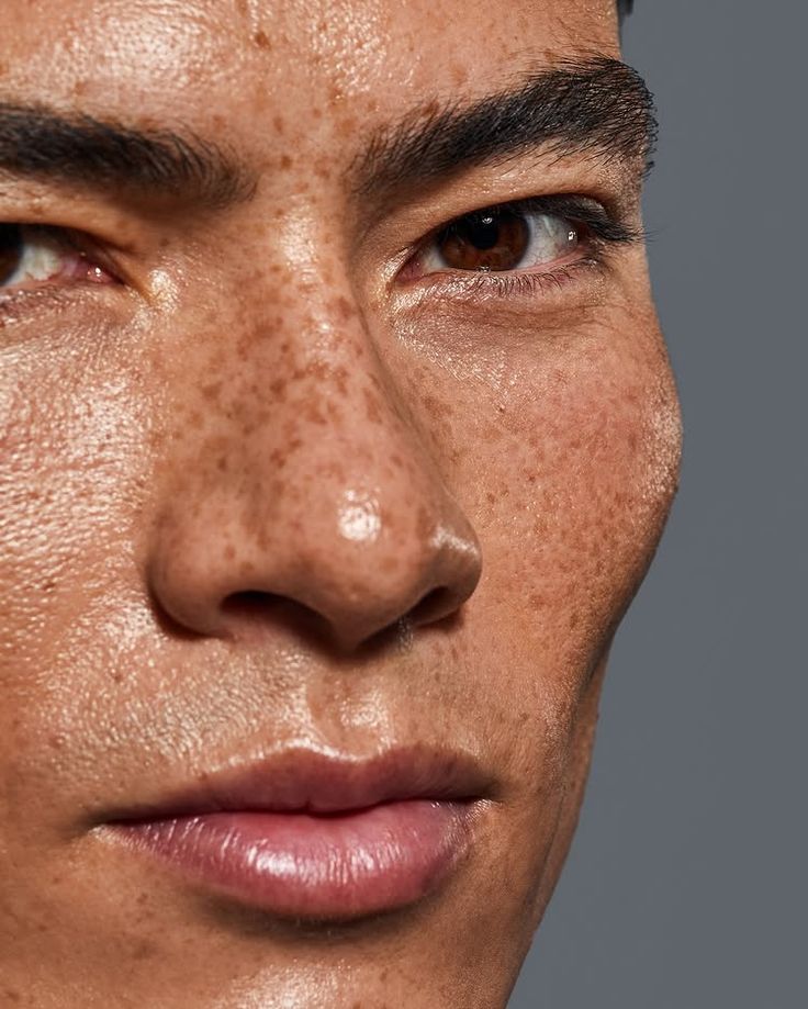 Tattoos or birthmarks