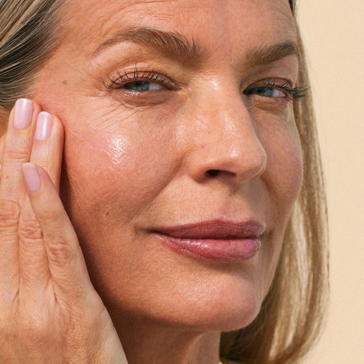 Acne scarring & post-inflammatory hyperpigmentation