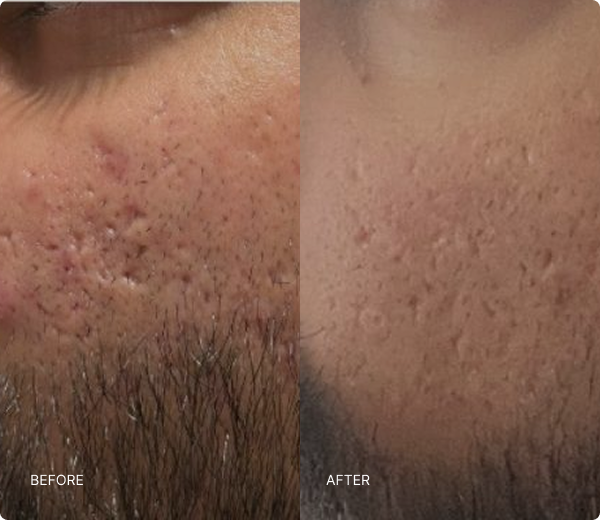 What NAD+ Therapy Can Help With