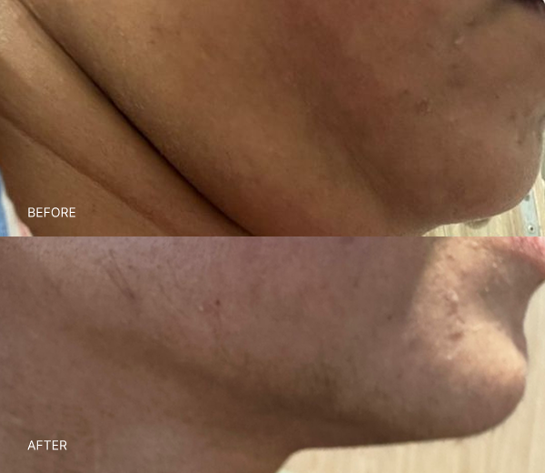 What NAD+ Therapy Can Help With