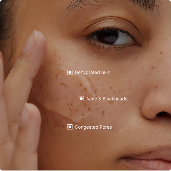 Perfect for sensitive skin types, this soothing treatment promotes cell renewal, enhances hydration, and restores a naturally radiant complexion.