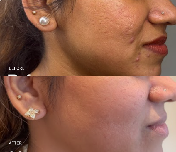 What NAD+ Therapy Can Help With